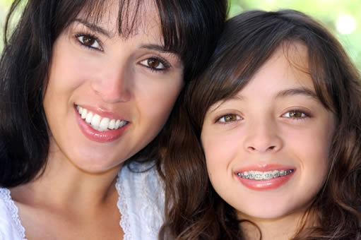 braces1